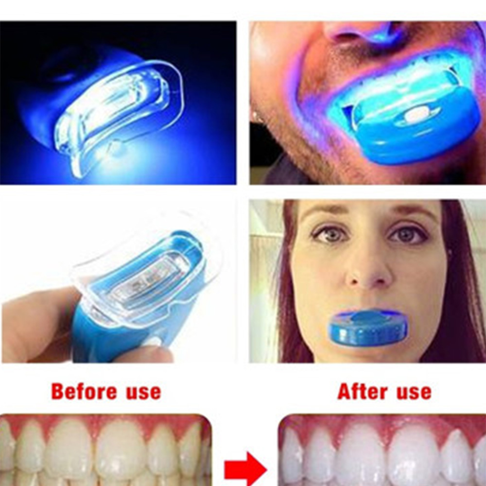 Teeth Whitening Laser Treatment - LED 치아 미백 라이트 미백 블루