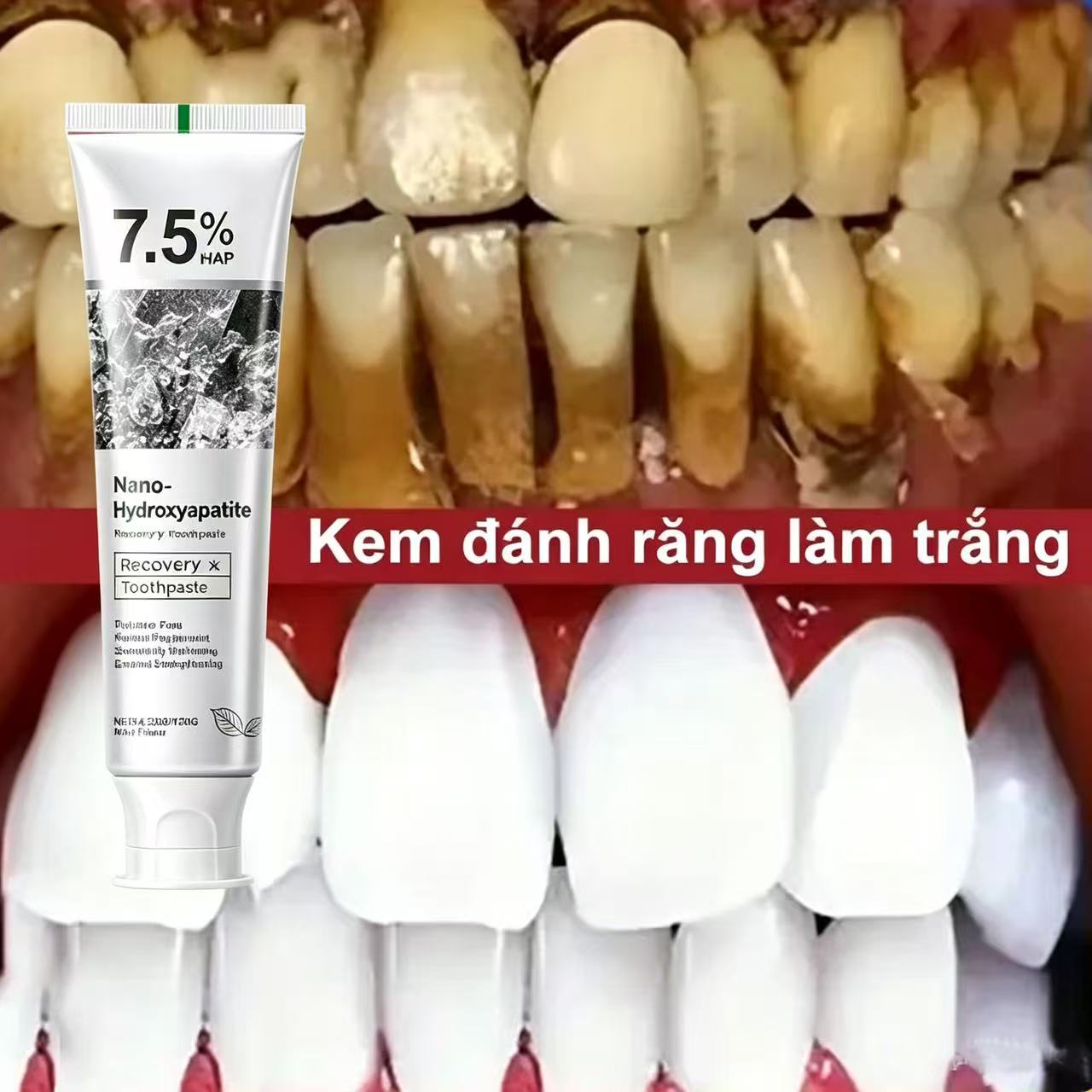 Teeth Whitening Best - 7.5% 하이드록시아파타이트 프로바이오틱 미백 치약 에나멜