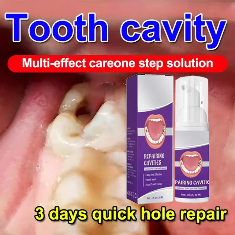 Teeth Whitening Best - 치아 세정 치약은 치아 얼룩 제거,