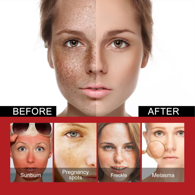 강력한 잡티 제거 화이트닝 크림, 피부를 빠르게 밝게  - Charcoal Whitening Paste 리뷰 및 가격