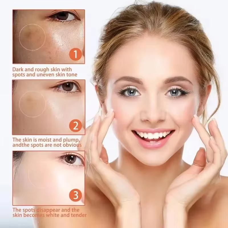 강력한 잡티 제거 화이트닝 크림, 피부를 빠르게 밝게  - Charcoal Whitening Paste 리뷰 및 가격