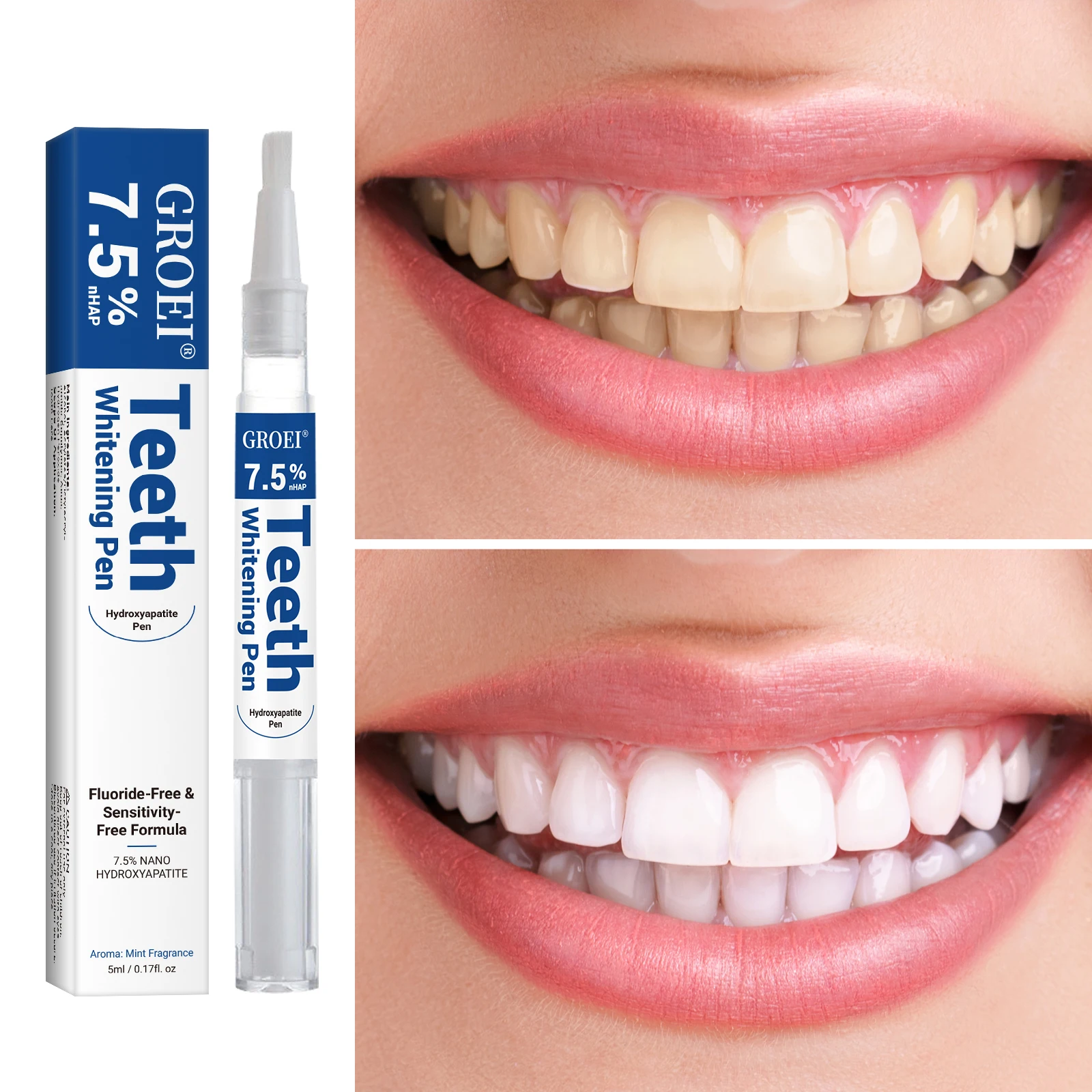 하이드록시아파타이트 치아 미백 펜 눈부신 화이트 얼룩  - Teeth Whitening Price 리뷰 및 가격