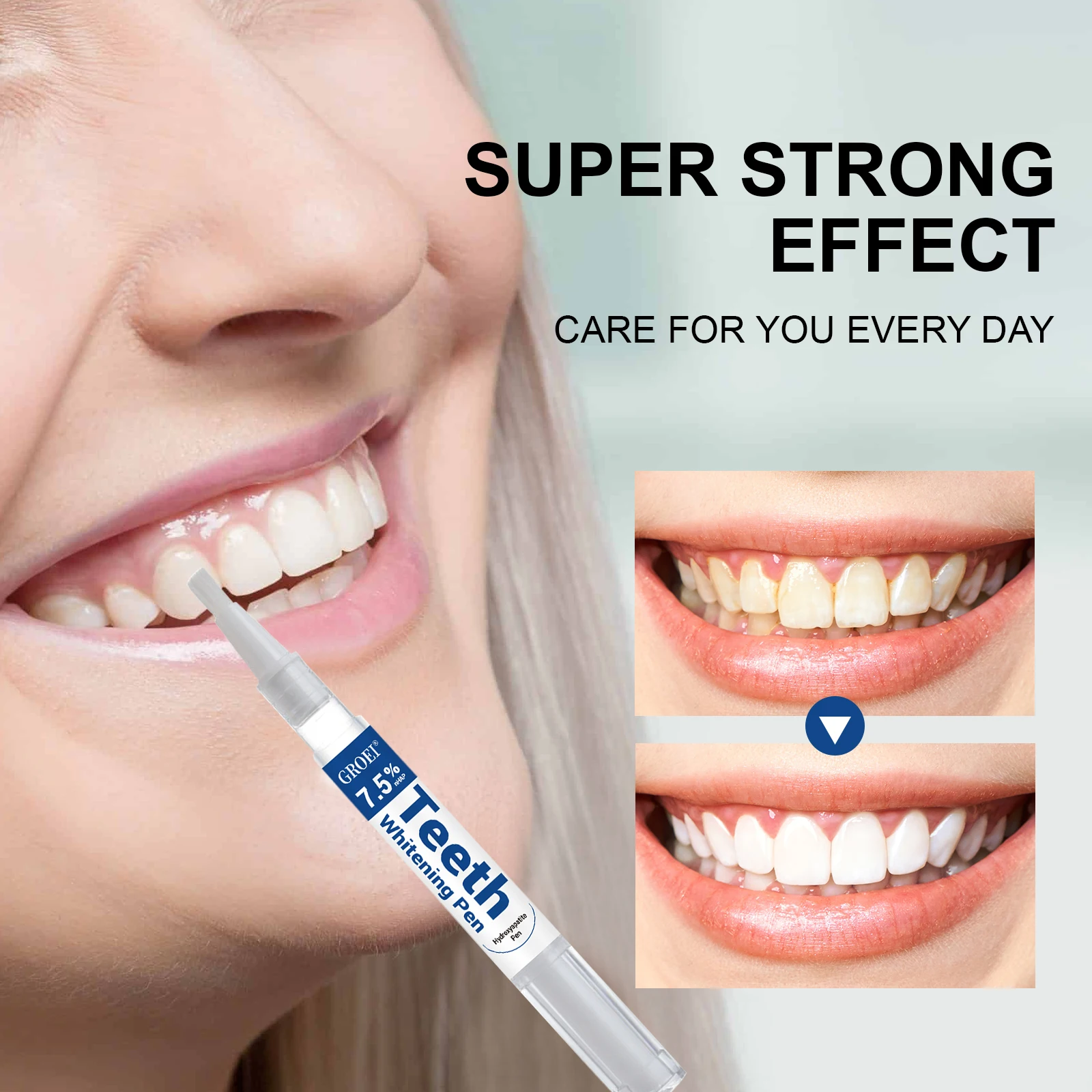 하이드록시아파타이트 치아 미백 펜 눈부신 화이트 얼룩  - Teeth Whitening Price 리뷰 및 가격