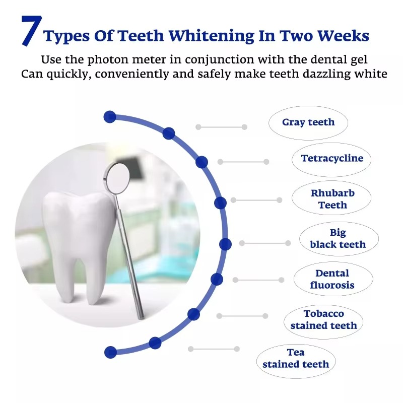지능형 LED 블루 라이트 휴대용 USB/iPhone/ - Teeth Whitening With Blue Light 리뷰 및 가격