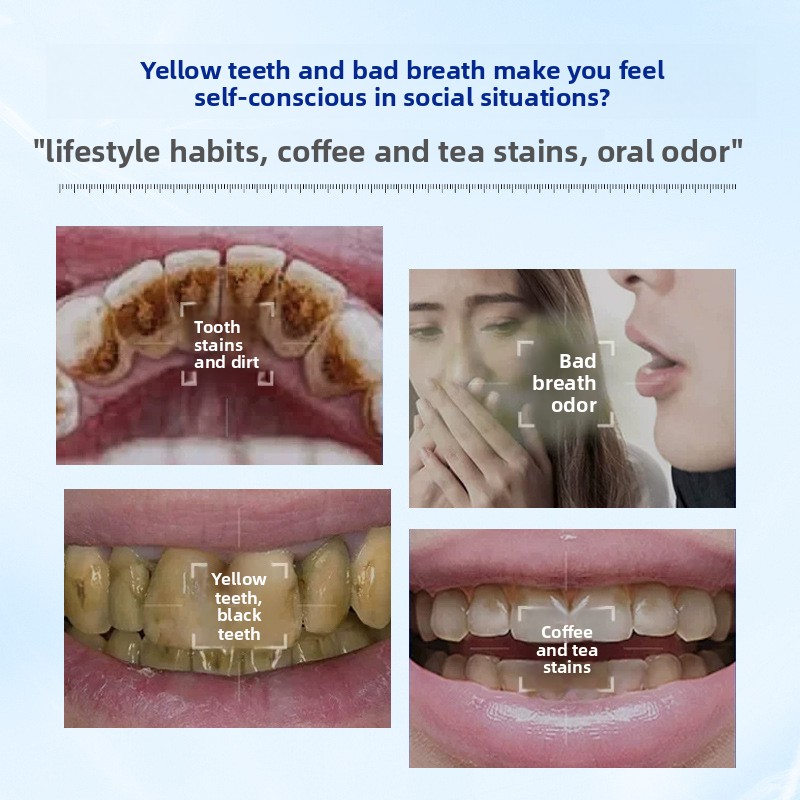 효소 미백 및 화이트닝 치약 가루, 건강한 치아와 잇몸 - Teeth Whitening Enzymes 리뷰 및 가격