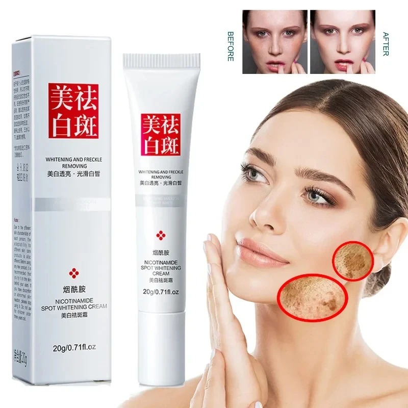 페이드 및 주근깨 개선 블랙 스팟 페이스 크림 화이트닝 - Charcoal Whitening Paste 리뷰 및 가격