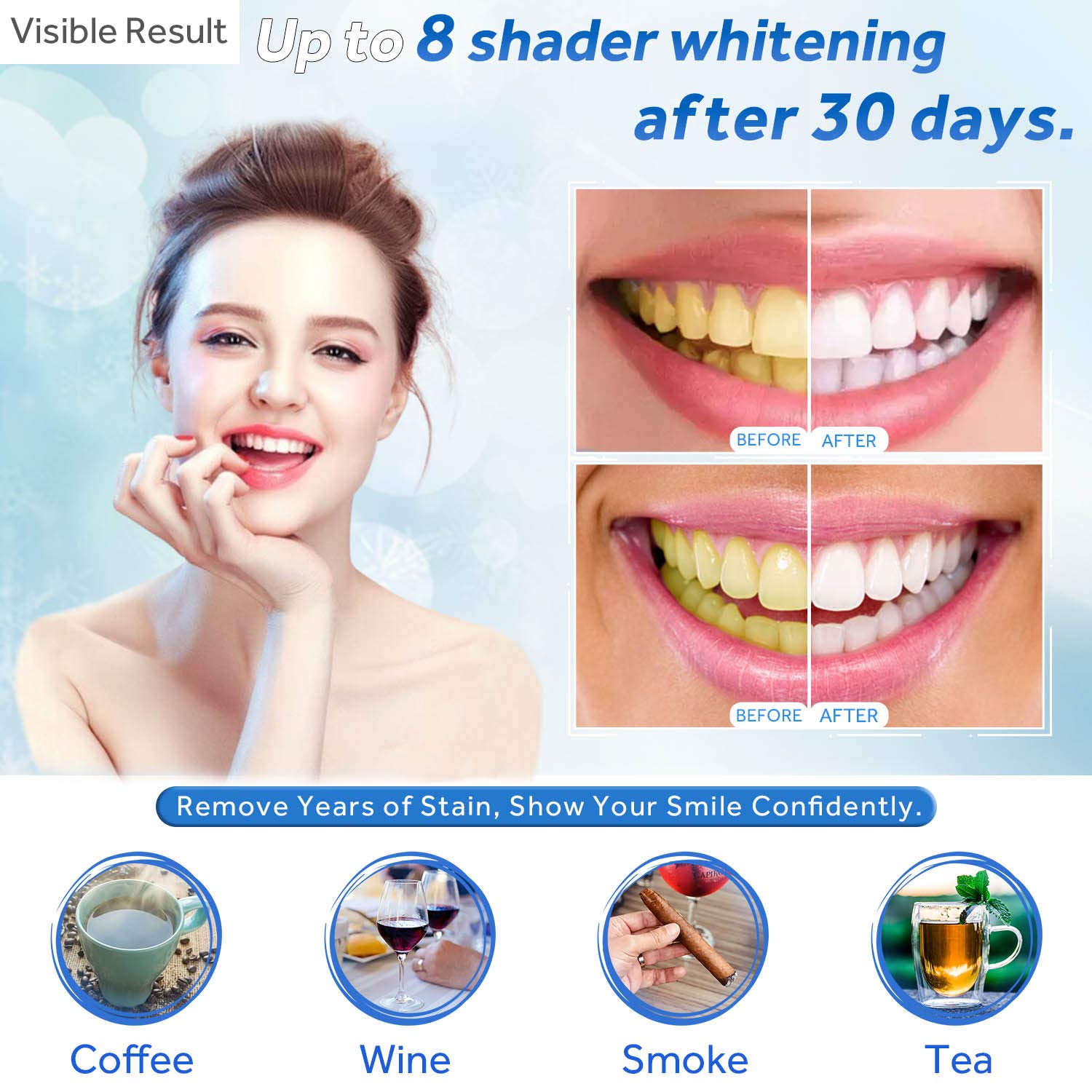 치아 미백 젤 리필 주사기 치아 미백 젤 인비스알라인  - Teeth Whitening With Peroxide 리뷰 및 가격