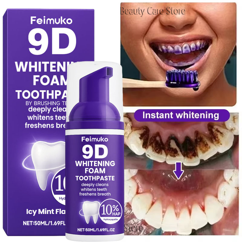 9D 퍼플 치아 미백 치약 무스, 누런 치아 및 플라그 - Teeth Whitening Best 리뷰 및 가격