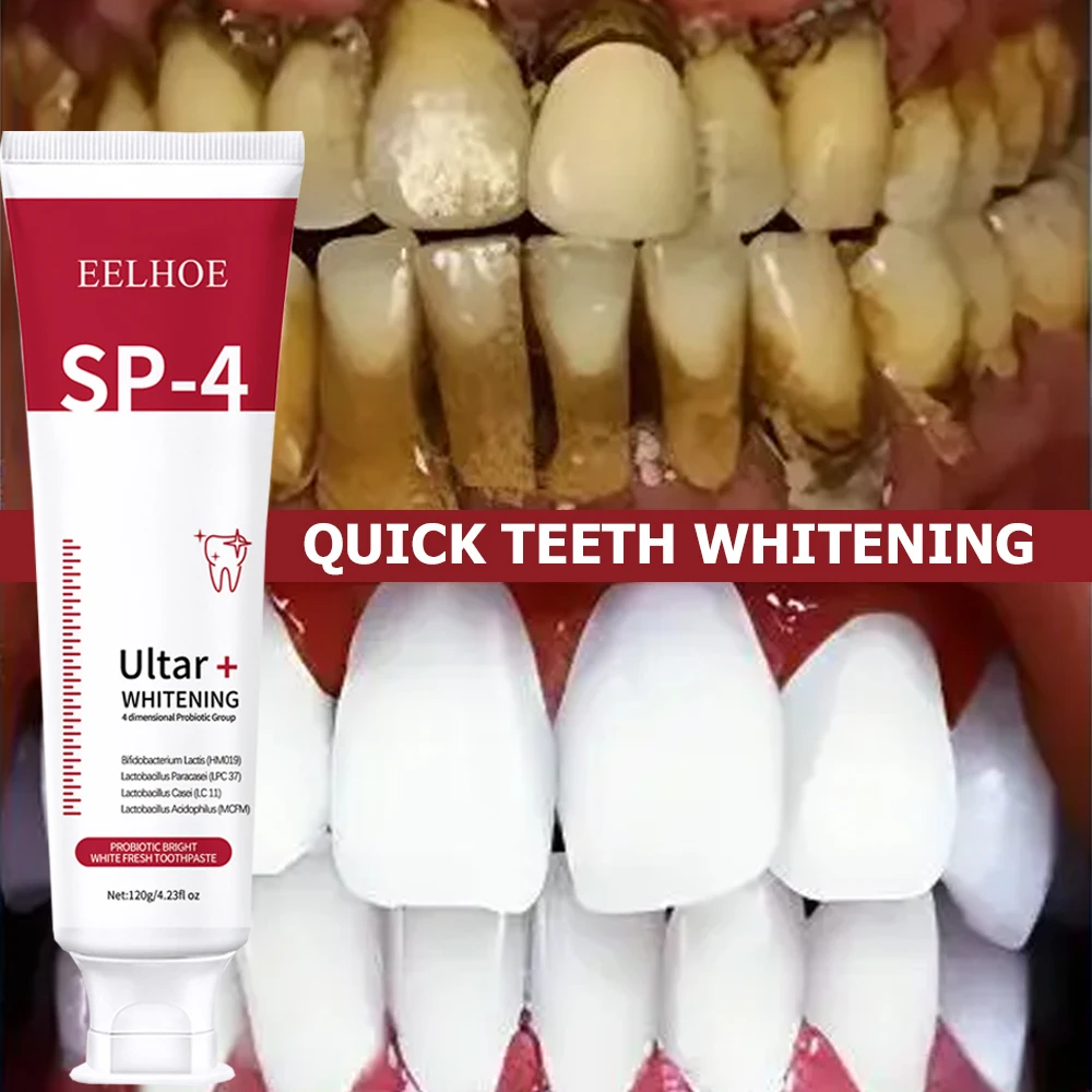 Sp-4 프로바이오틱 미백 치약, 구강 냄새 제거, 치 - Teeth Whitening Enzymes 리뷰 및 가격