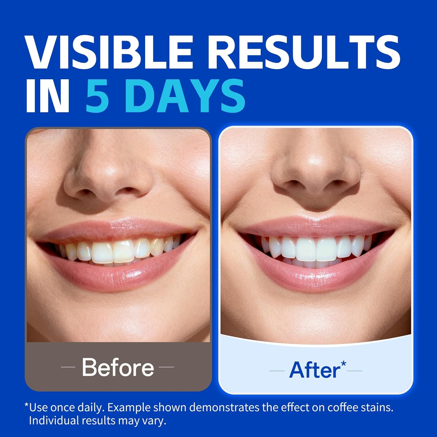 1/7쌍 치아 미백 스트립, 더 하얗게 보이는 미소를  - Teeth Whitening Strips Crest 리뷰 및 가격