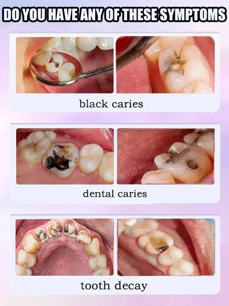 치아 세정 치약은 치아 얼룩 제거, 치아 미백, 치아  - Teeth Whitening Best 리뷰 및 가격